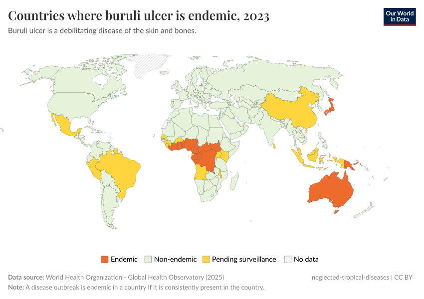 A thumbnail of the "Countries where buruli ulcer is endemic" chart